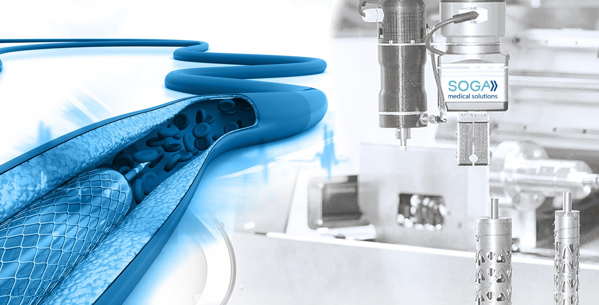 Stent manufacturing project support