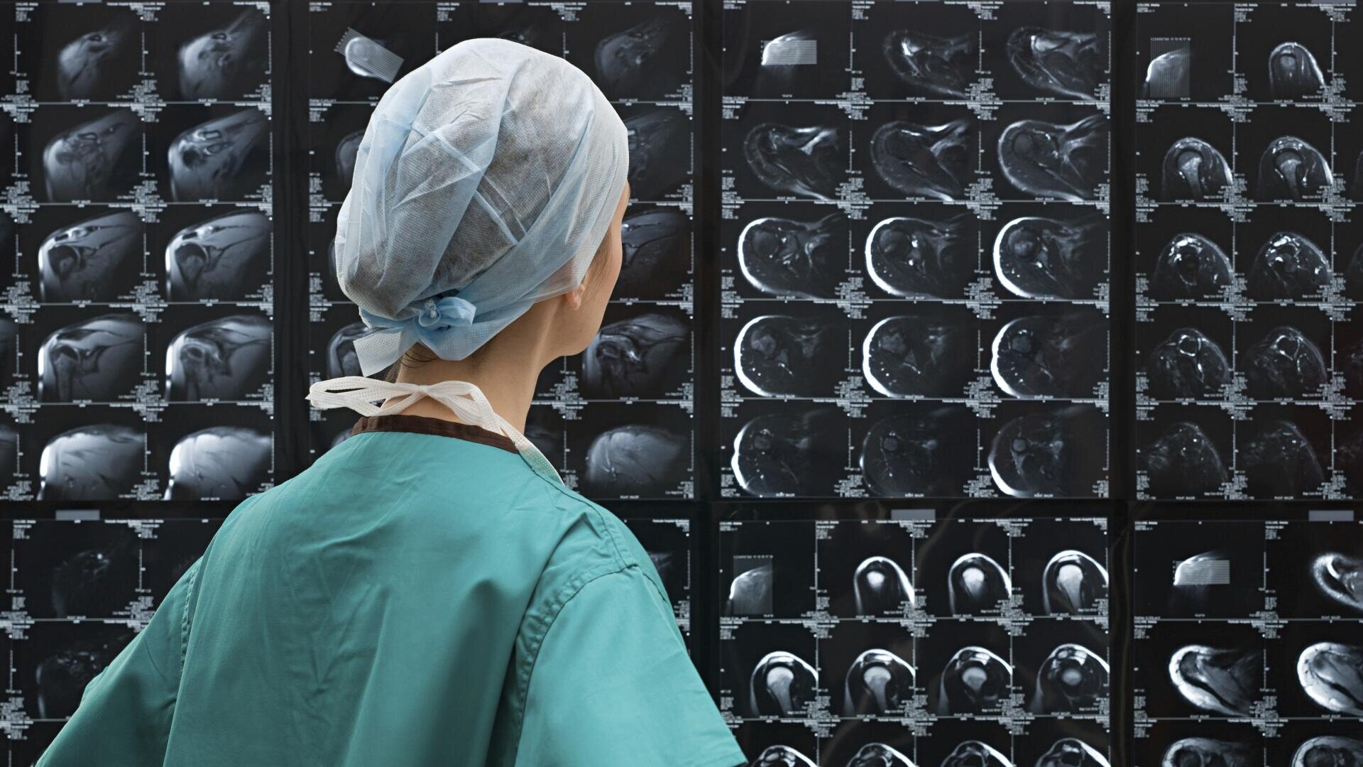 Ein Mediziner im OP-Kittel und mit einer Haarkappe steht vor einem großen Bildschirm mit MRT- oder CT-Bildern und untersucht die Schwarz-Weiß-Gehirnscans genau.