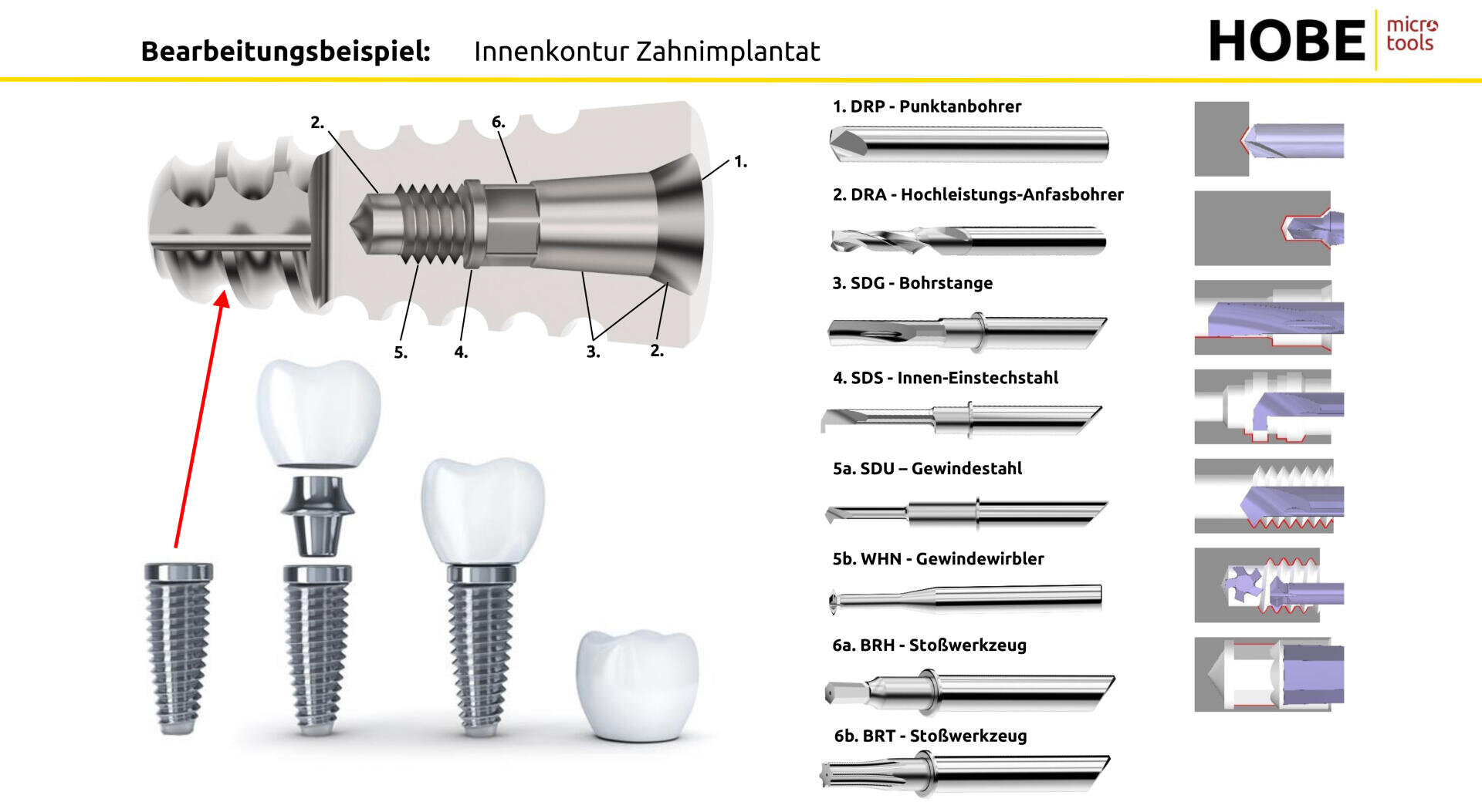 Diagram showing the step-by-step process of making dental implants, with labeled tools and cross-sectional views of the jawbone, implant and crown, as well as detailed illustrations of the individual tools used in the process.
