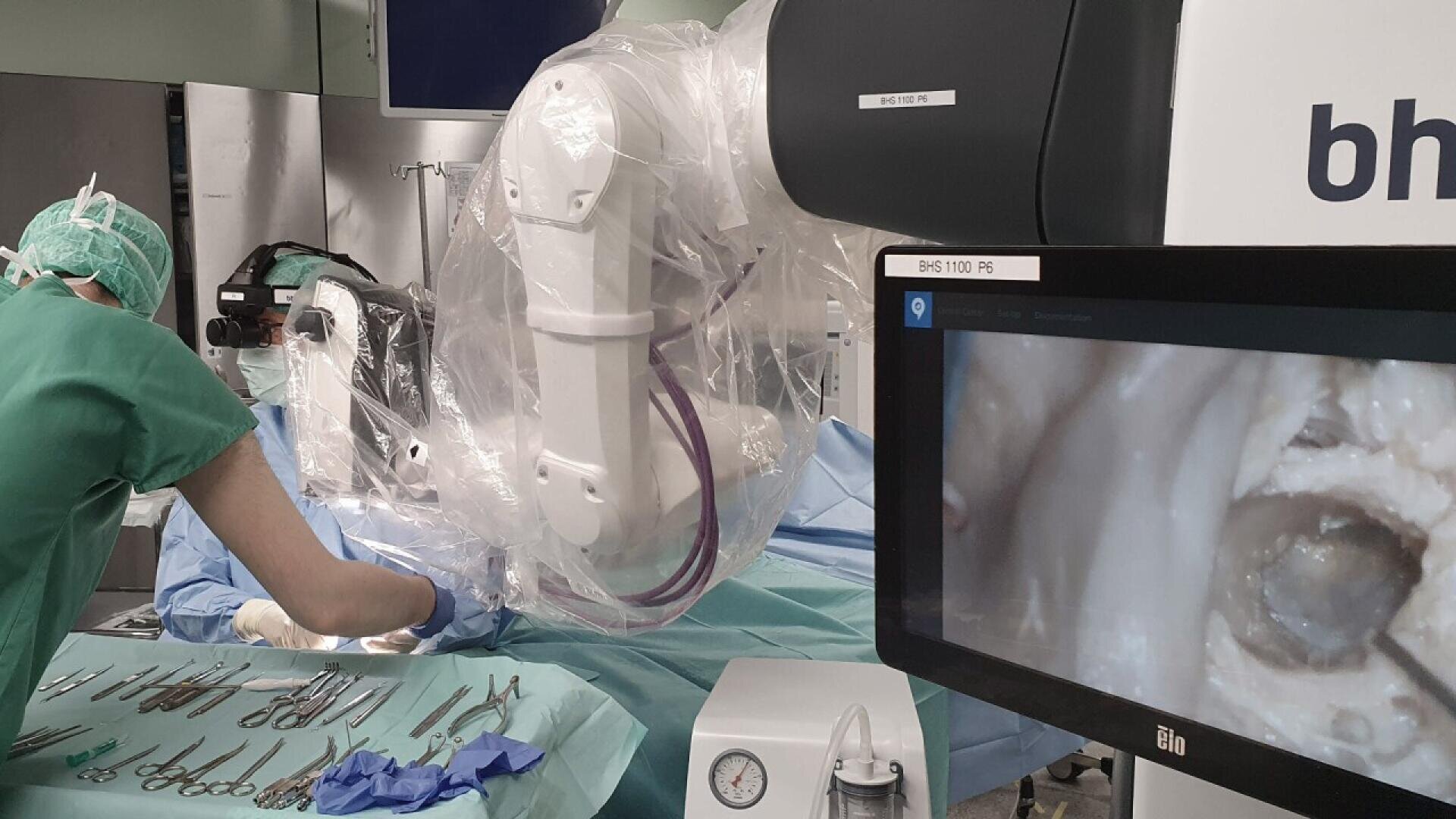 A surgeon works beside a robotic arm covered in plastic in an operating room. Surgical tools are arranged on a table, and a monitor displays a close-up medical image from the ongoing procedure.