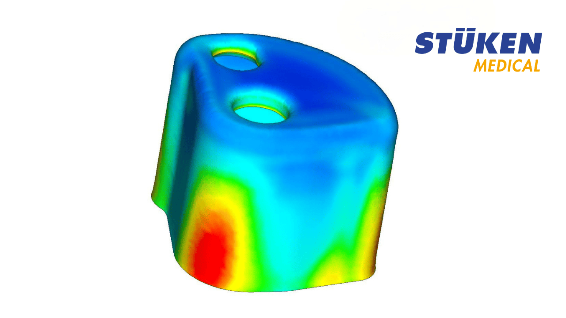 A color gradient simulation of a small, irregularly shaped object with two holes showing the voltage distribution; blue means low voltage and red means high voltage. The STÜKEN MEDICAL logo is located in the upper right corner.