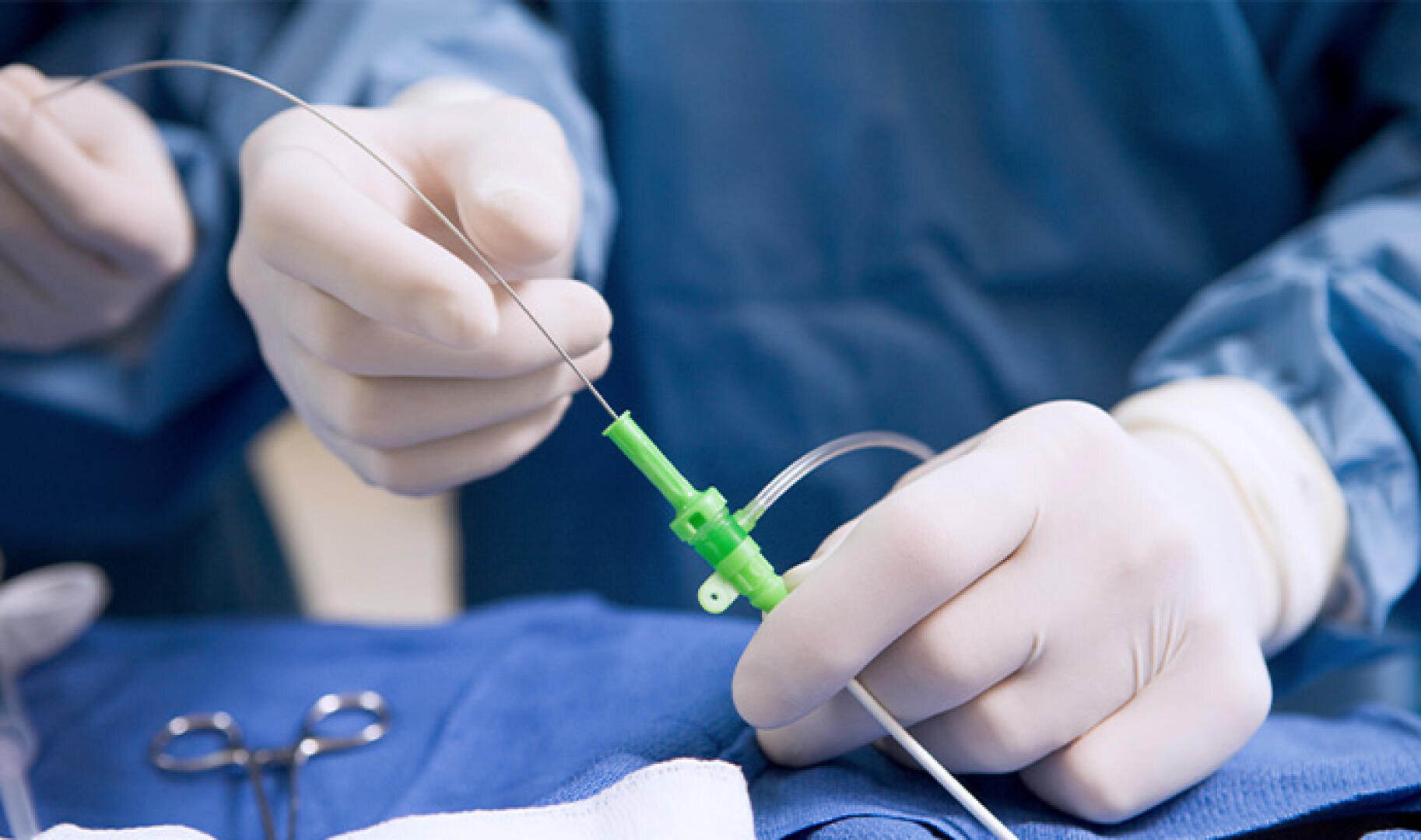 Die behandschuhten Hände einer medizinischen Fachkraft führen während eines chirurgischen Eingriffs einen Katheter oder einen Führungsdraht in einen Patienten ein, während im Hintergrund chirurgische Werkzeuge und ein blaues Tuch zu sehen sind.