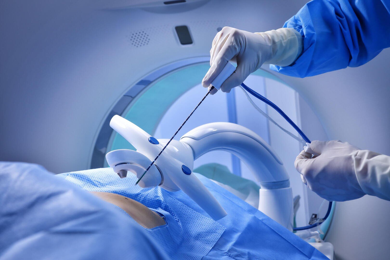 A medical professional in sterile gloves and gown operates advanced robotic equipment near a patient covered in blue drapes, likely during a minimally invasive procedure or scan.