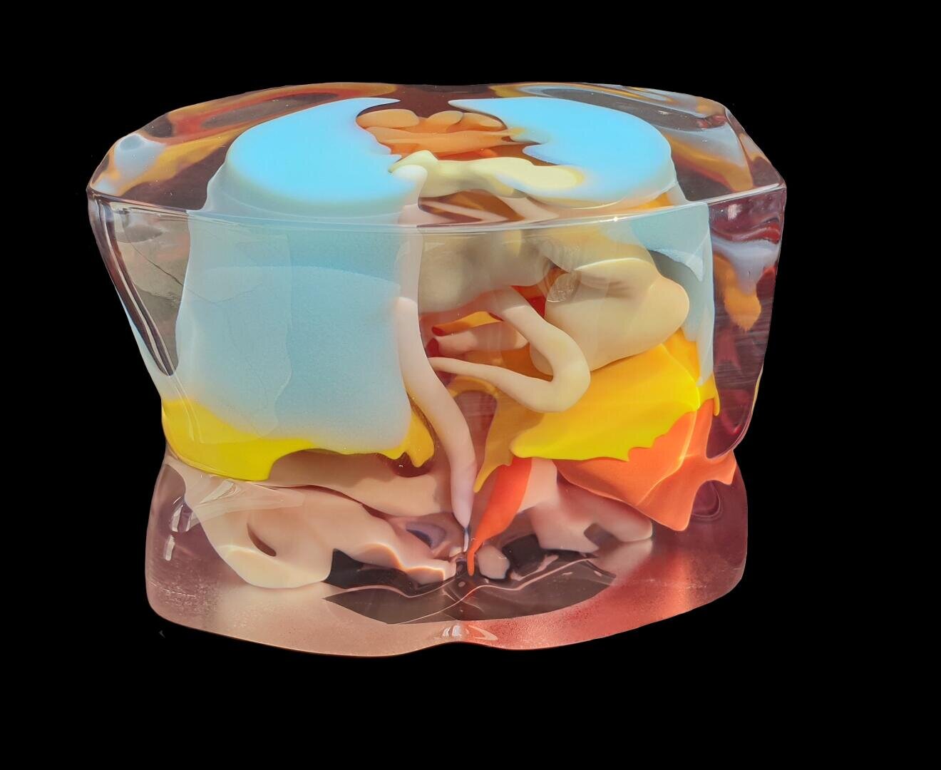 Ein 3D-anatomisches Modell eines menschlichen Wirbels und Rückenmarks, das detaillierte Schichten von Knochen, Nerven und Bandscheibenstrukturen zeigt, eingeschlossen in einer transparenten Hülle auf schwarzem Hintergrund.
