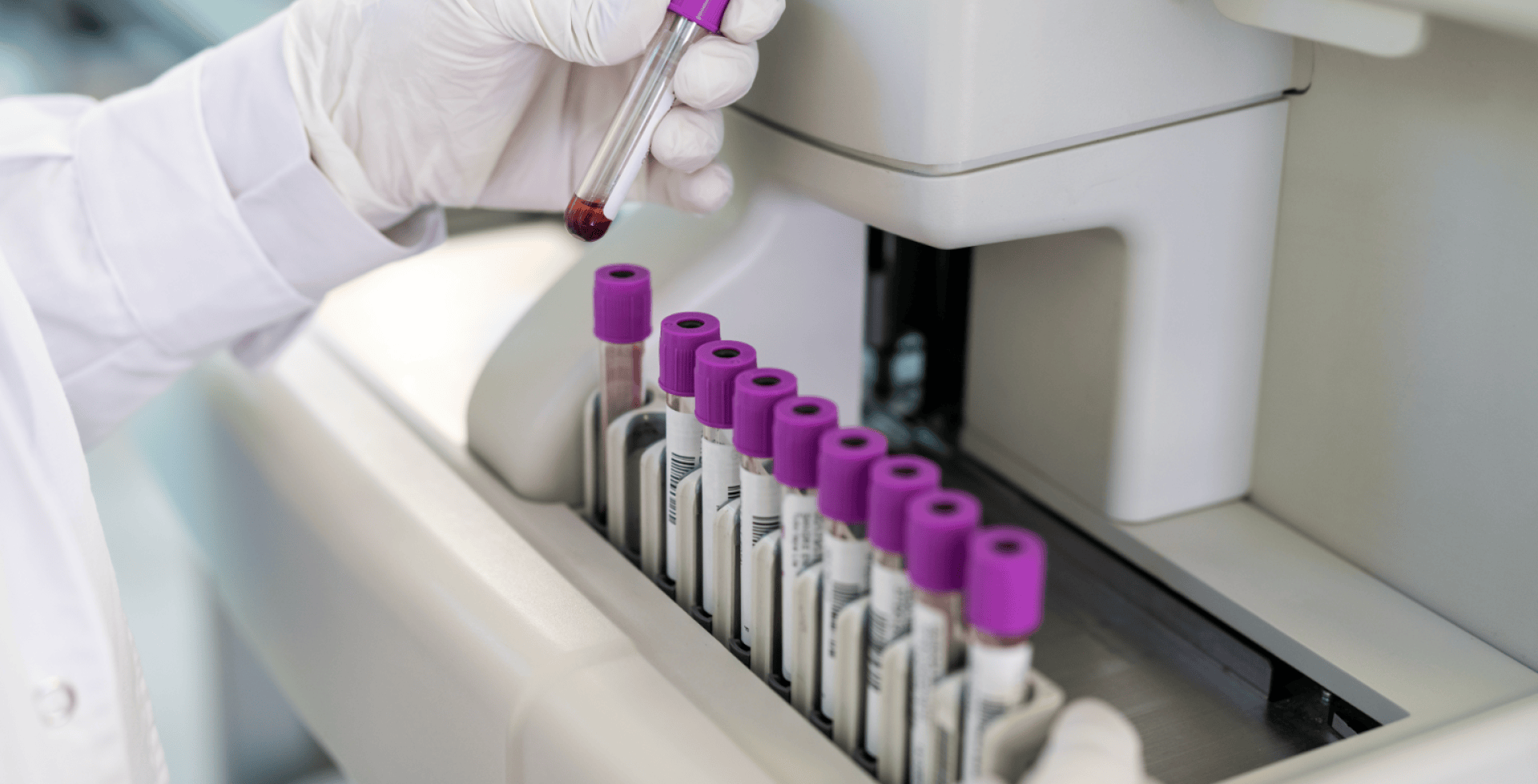 A gloved hand places a blood sample tube with a purple cap into a medical analyzer, alongside several similar tubes lined up in the machine.