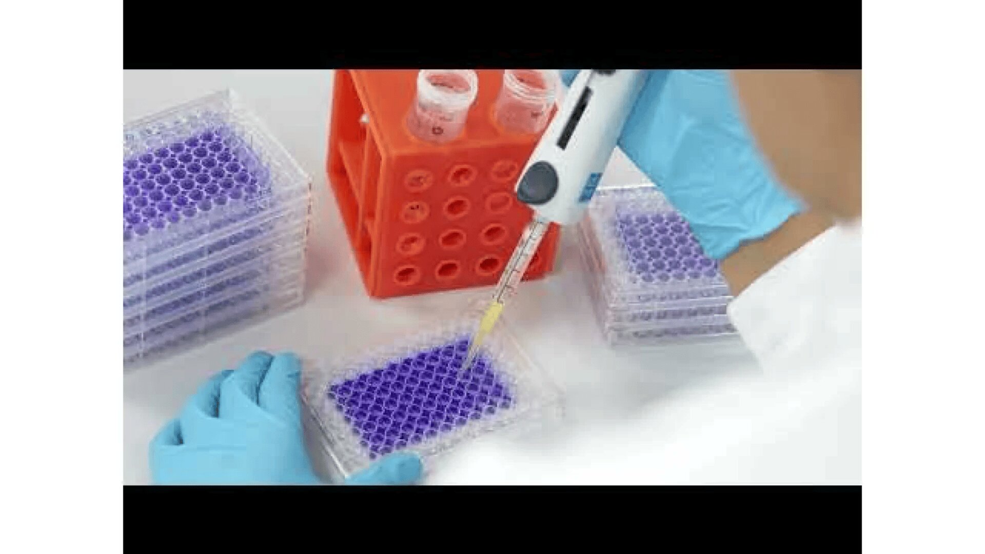 A person wearing blue gloves uses a pipette to transfer liquid into a clear multi-well plate filled with purple solution, with more plates and test tubes in an orange rack nearby.