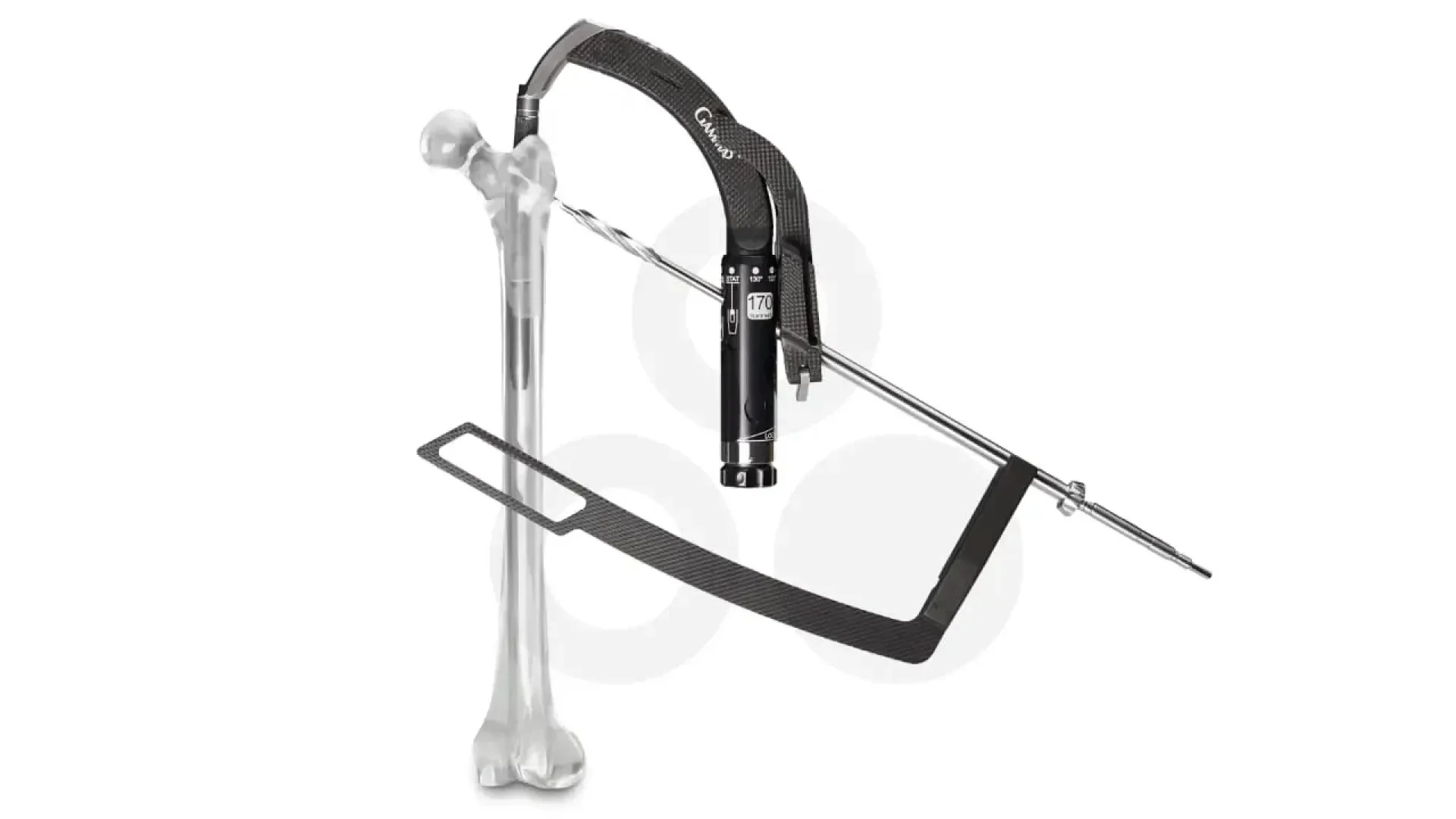 Ein medizinisches Gerät ist an einem transparenten Oberschenkelmodell befestigt, das einen schwarzen Riemen, ein zylindrisches Instrument und einen langen Metallstab aufweist, die wahrscheinlich für orthopädische chirurgische Eingriffe oder die Ausrichtung von Knochen verwendet werden.
