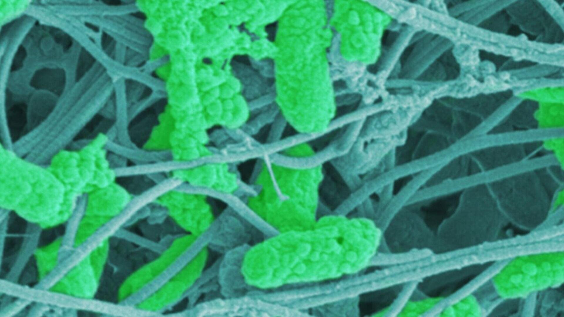 Microscopic image showing green rod-shaped bacteria entangled among blue, fibrous, hair-like structures, possibly biofilm, magnified to reveal cellular and structural detail.
